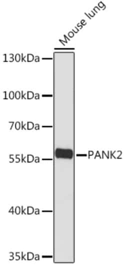 Invitrogen PANK2 Polyclonal Antibody 100 &mu;L; Unconjugated:Antibodies,