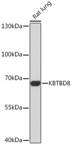 Invitrogen KBTBD8 Polyclonal Antibody 100 μL; Unconjugated:Antibodies,