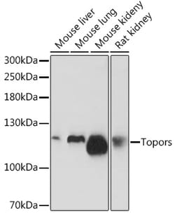 Invitrogen TOPORS Polyclonal Antibody 100 &mu;L; Unconjugated:Antibodies,