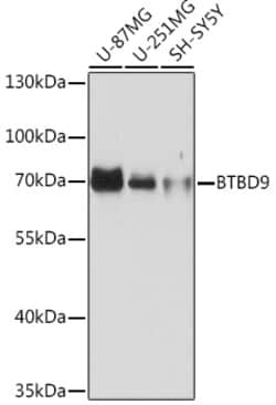 Invitrogen BTBD9 Polyclonal Antibody 100 &mu;L | Buy Online | Invitrogen&trade; | Fisher Scientific