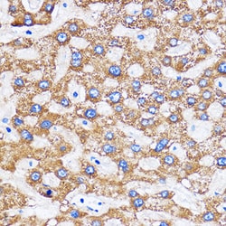 Invitrogen MITD1 Polyclonal Antibody 100 &mu;L; Unconjugated:Antibodies,