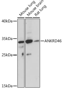 ANKRD46 Polyclonal Antibody:Antibodies, Polyclonal
