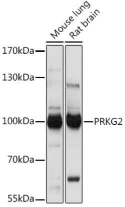 Invitrogen cGKII Polyclonal Antibody 100 μL; Unconjugated:Antibodies,