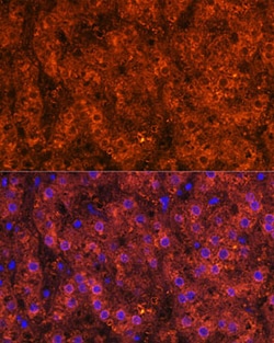 Invitrogen ADH1A/ADH1B/ADH1C Polyclonal Antibody 100 &mu;L; Unconjugated:Antibodies,