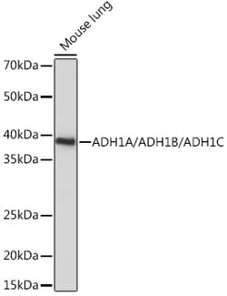 Invitrogen ADH1A/ADH1B/ADH1C Polyclonal Antibody 100 &mu;L; Unconjugated:Antibodies,