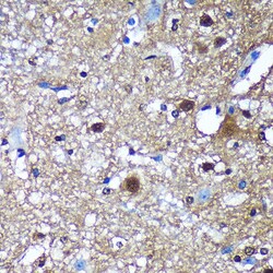 Invitrogen TSN Polyclonal Antibody 100 &mu;L; Unconjugated:Antibodies,