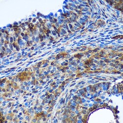 Invitrogen TSN Polyclonal Antibody 100 &mu;L; Unconjugated:Antibodies,