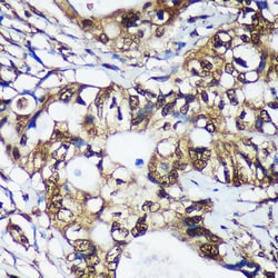 Invitrogen TSN Polyclonal Antibody 100 &mu;L; Unconjugated:Antibodies,