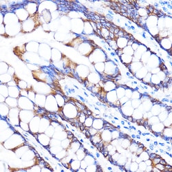 Invitrogen&trade;&nbsp;ZMPSTE24 Polyclonal Antibody