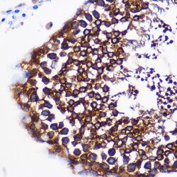 PTGES Polyclonal Antibody:Antibodies, Polyclonal