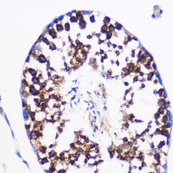 PTGES Polyclonal Antibody:Antibodies, Polyclonal