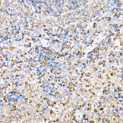 Invitrogen MHC Class II (I-Ab) Polyclonal Antibody 100 &mu;L; Unconjugated:Antibodies,