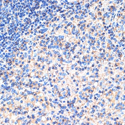 Invitrogen SIGLEC15 Polyclonal Antibody 100 &mu;L; Unconjugated:Antibodies,