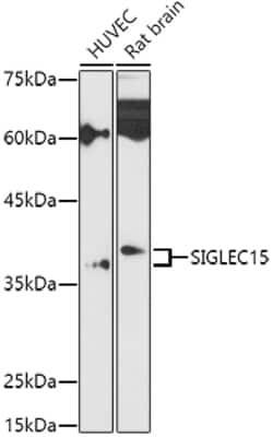 Invitrogen SIGLEC15 Polyclonal Antibody 100 &mu;L; Unconjugated:Antibodies,