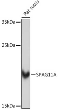 Invitrogen SPAG11A Polyclonal Antibody 100 &mu;L; Unconjugated:Antibodies,
