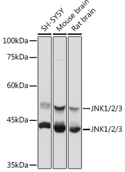 Invitrogen JNK1/JNK2/JNK3 Polyclonal Antibody 100 &mu;L | Buy Online | Invitrogen&trade; | Fisher Scientific
