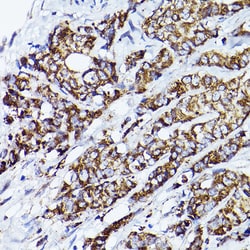 Invitrogen VDAC2 Polyclonal Antibody 100 &mu;L | Buy Online | Invitrogen&trade; | Fisher Scientific
