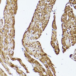 Invitrogen VDAC2 Polyclonal Antibody 100 &mu;L | Buy Online | Invitrogen&trade; | Fisher Scientific