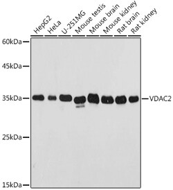 Invitrogen VDAC2 Polyclonal Antibody 100 &mu;L | Buy Online | Invitrogen&trade; | Fisher Scientific