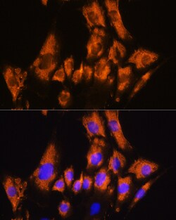 Invitrogen CDH8 Polyclonal Antibody 100 &mu;L; Unconjugated:Antibodies,