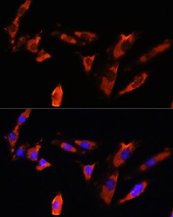 Invitrogen CDH8 Polyclonal Antibody 100 &mu;L; Unconjugated:Antibodies,