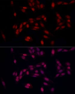 Invitrogen SUPT16H Polyclonal Antibody 100 &mu;L; Unconjugated:Antibodies,