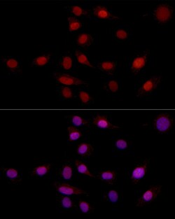 Invitrogen SUPT16H Polyclonal Antibody 100 &mu;L; Unconjugated:Antibodies,
