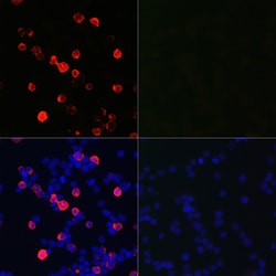 Invitrogen SARS-CoV-2 Nucleocapsid Polyclonal Antibody 100 &mu;L; Unconjugated:Antibodies,