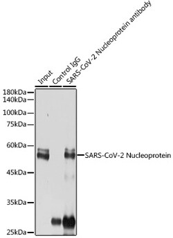 Invitrogen SARS-CoV-2 Nucleocapsid Polyclonal Antibody 100 &mu;L; Unconjugated:Antibodies,