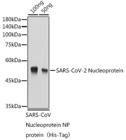 Invitrogen SARS-CoV-2 Nucleocapsid Polyclonal Antibody 100 &mu;L; Unconjugated:Antibodies,