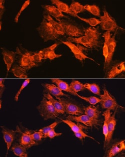 Invitrogen TrkA/TrkB/TrkC Polyclonal Antibody 100 &mu;L | Buy Online | Invitrogen&trade; | Fisher Scientific