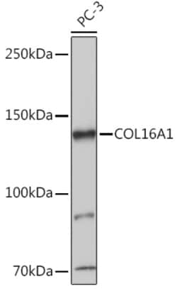 Invitrogen COL16A1 Polyclonal Antibody 100 &mu;L; Unconjugated:Antibodies,