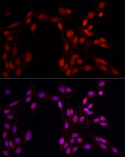 Invitrogen Lamin B1 Polyclonal Antibody 100 &mu;L; Unconjugated:Antibodies,