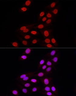 Invitrogen Lamin B1 Polyclonal Antibody 100 &mu;L; Unconjugated:Antibodies,