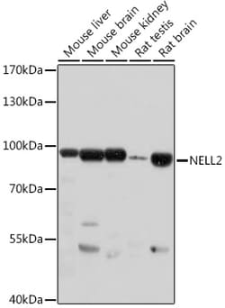 Invitrogen NELL2 Polyclonal Antibody 100 &mu;L; Unconjugated:Antibodies,