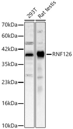 Invitrogen RNF126 Polyclonal Antibody 100 &mu;L; Unconjugated:Antibodies,