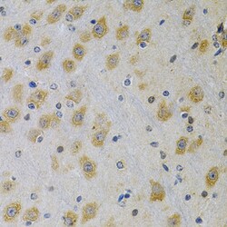 Invitrogen IGFBP4 Polyclonal Antibody 100 &mu;L; Unconjugated:Antibodies,