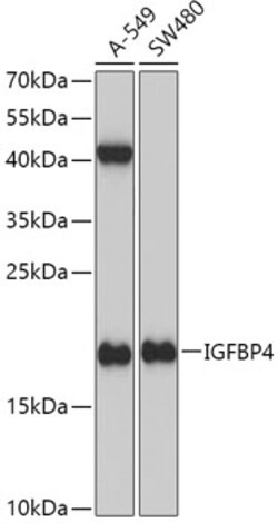 Invitrogen IGFBP4 Polyclonal Antibody 100 &mu;L; Unconjugated:Antibodies,