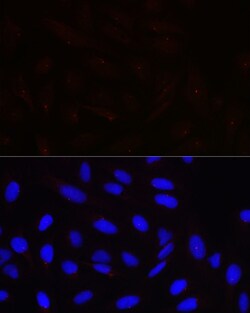 Invitrogen Pericentrin Polyclonal Antibody 100 &mu;L; Unconjugated:Antibodies,