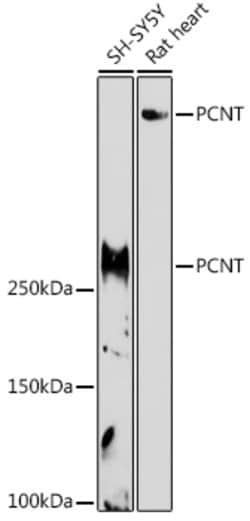 Invitrogen Pericentrin Polyclonal Antibody 100 &mu;L; Unconjugated:Antibodies,