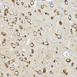 Invitrogen ATP6V1G2 Polyclonal Antibody 100 &mu;L; Unconjugated:Antibodies,