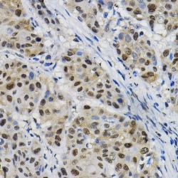 Invitrogen DNAJC17 Polyclonal Antibody 100 &mu;L | Buy Online | Invitrogen&trade; | Fisher Scientific