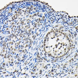 Invitrogen hnRNP A3 Polyclonal Antibody 100 &mu;L; Unconjugated:Antibodies,