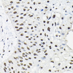 Invitrogen hnRNP A3 Polyclonal Antibody 100 &mu;L; Unconjugated:Antibodies,