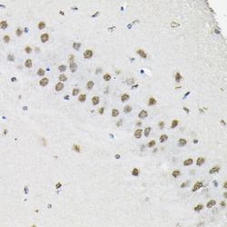 Invitrogen hnRNP A3 Polyclonal Antibody 100 &mu;L; Unconjugated:Antibodies,