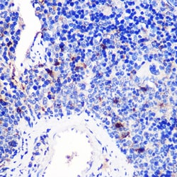 Invitrogen CD137 (4-1BB) Polyclonal Antibody 100 &mu;L; Unconjugated:Antibodies,