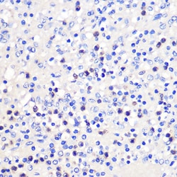 Invitrogen CD137 (4-1BB) Polyclonal Antibody 100 &mu;L; Unconjugated:Antibodies,