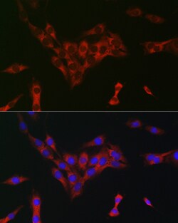 Invitrogen EIF4A1/EIF4A2/EIF4A3 Polyclonal Antibody 100 &mu;L; Unconjugated:Antibodies,