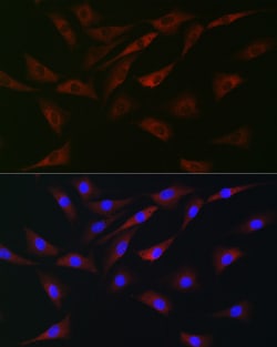 Invitrogen EIF4A1/EIF4A2/EIF4A3 Polyclonal Antibody 100 &mu;L; Unconjugated:Antibodies,