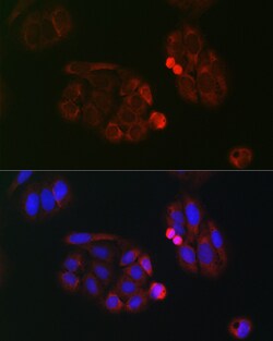 Invitrogen EIF4A1/EIF4A2/EIF4A3 Polyclonal Antibody 100 &mu;L; Unconjugated:Antibodies,